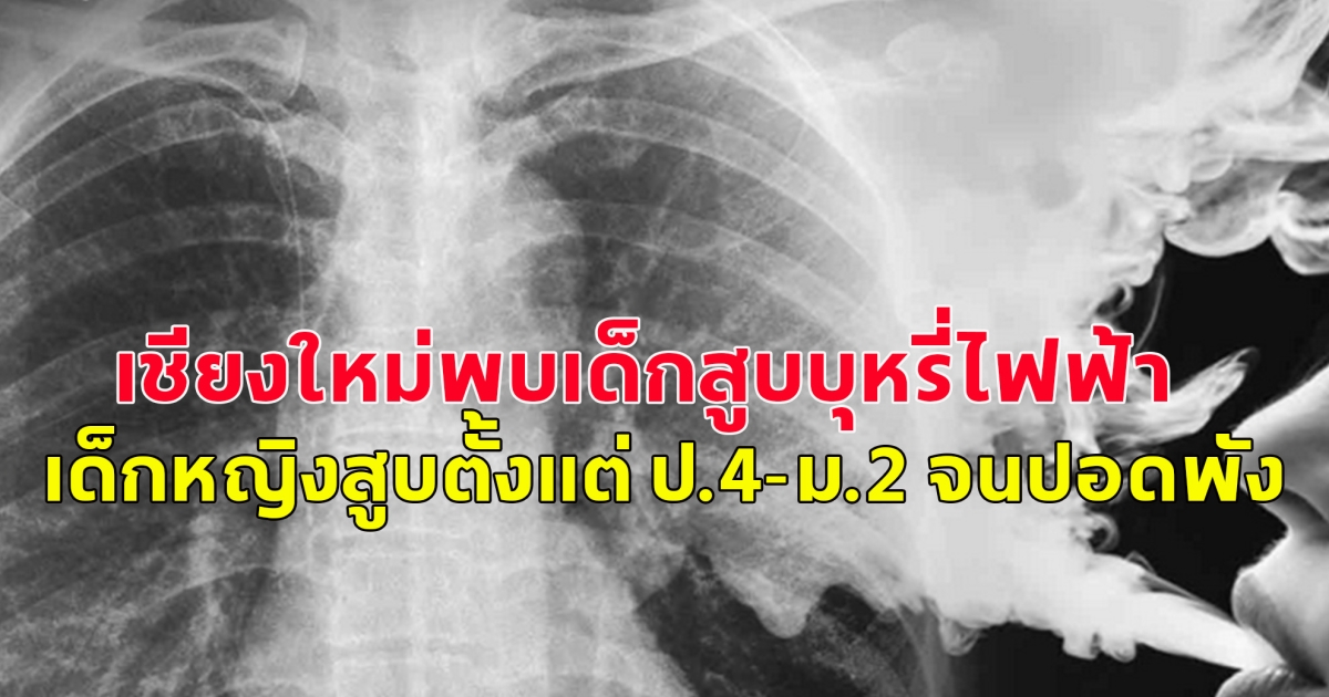 เชียงใหม่พบเด็กสูบบุหรี่ไฟฟ้า 1,884 คน พบเด็กหญิงสูบตั้งแต่ ป.4-ม.2 จนปอดพัง