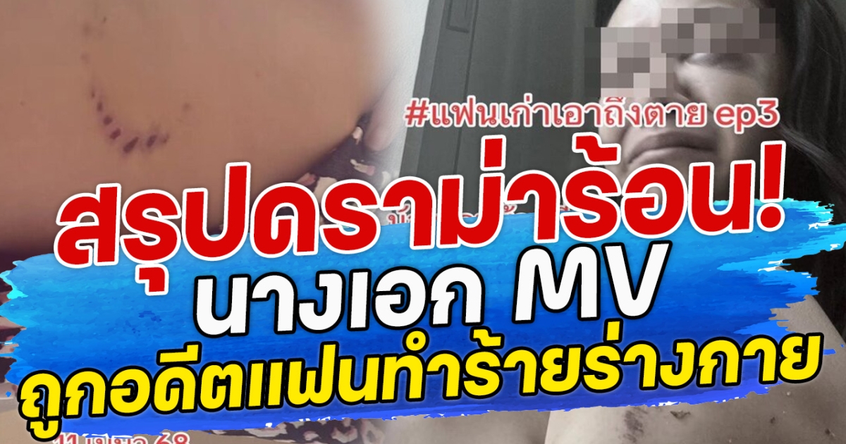สรุปดราม่าร้อน! นางเอก MV ถูกอดีตแฟนทำร้ายร่างกาย