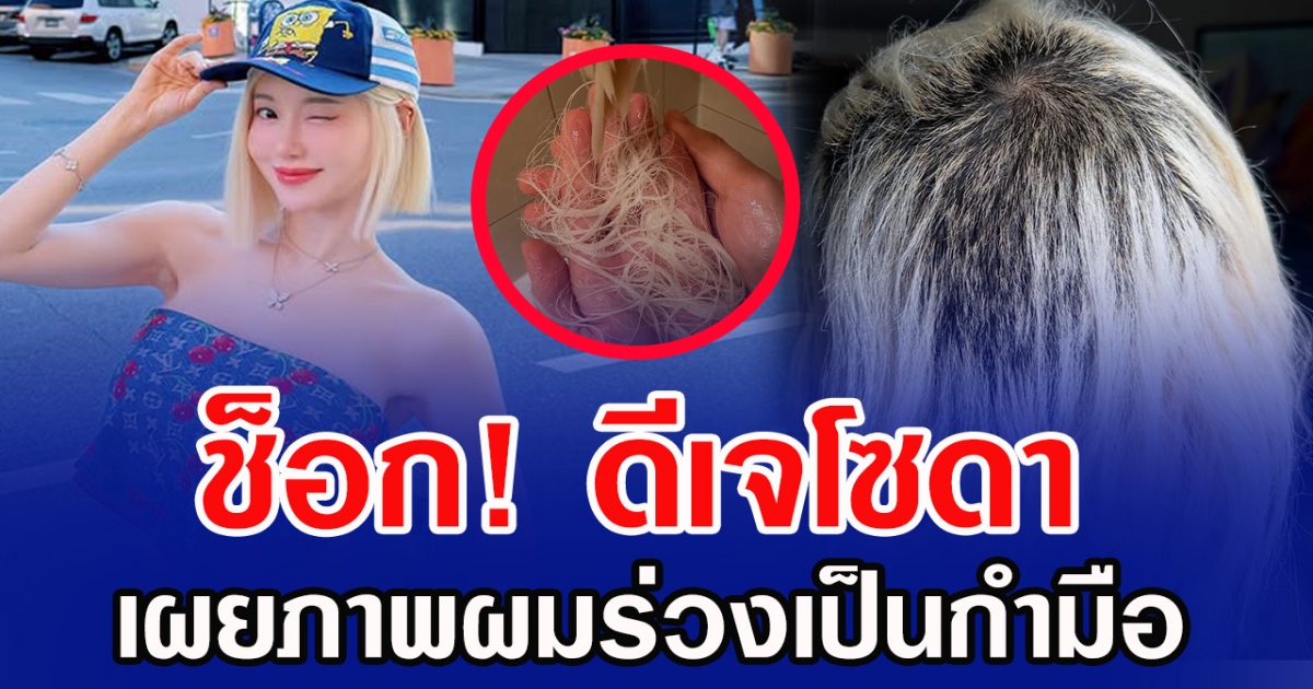 ช็อก ดีเจโซดา เผยภาพผมร่วงเป็นกำมือ