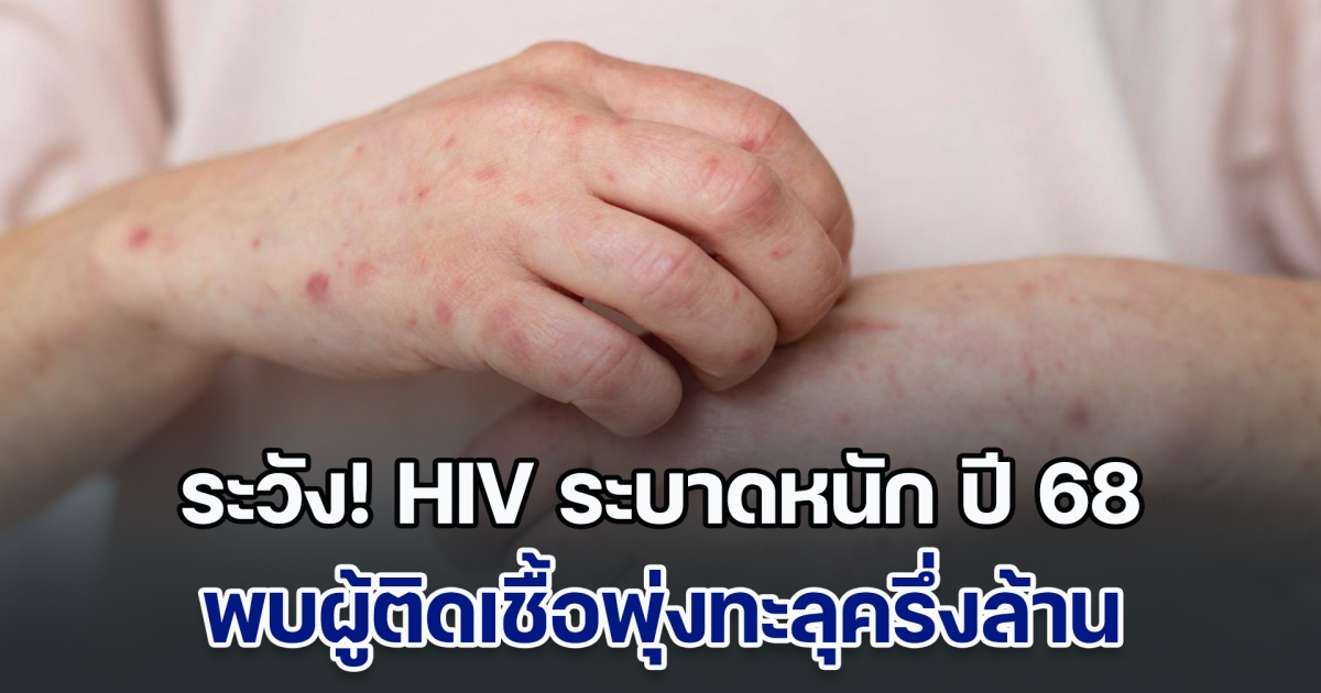ระวัง! HIV ระบาดหนัก ปี 68 ติดเชื้อพุ่งทะลุครึ่งล้าน ป่วยรายใหม่กว่า 13,000 ราย ชี้มีอีกหลายคนไม่รู้สถานะการติดเชื้อ
