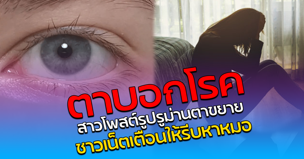 ตาบอกโรค สาวโพสต์รูปรูม่านตาขยาย ชาวเน็ตเตือนให้รีบหาหมอ