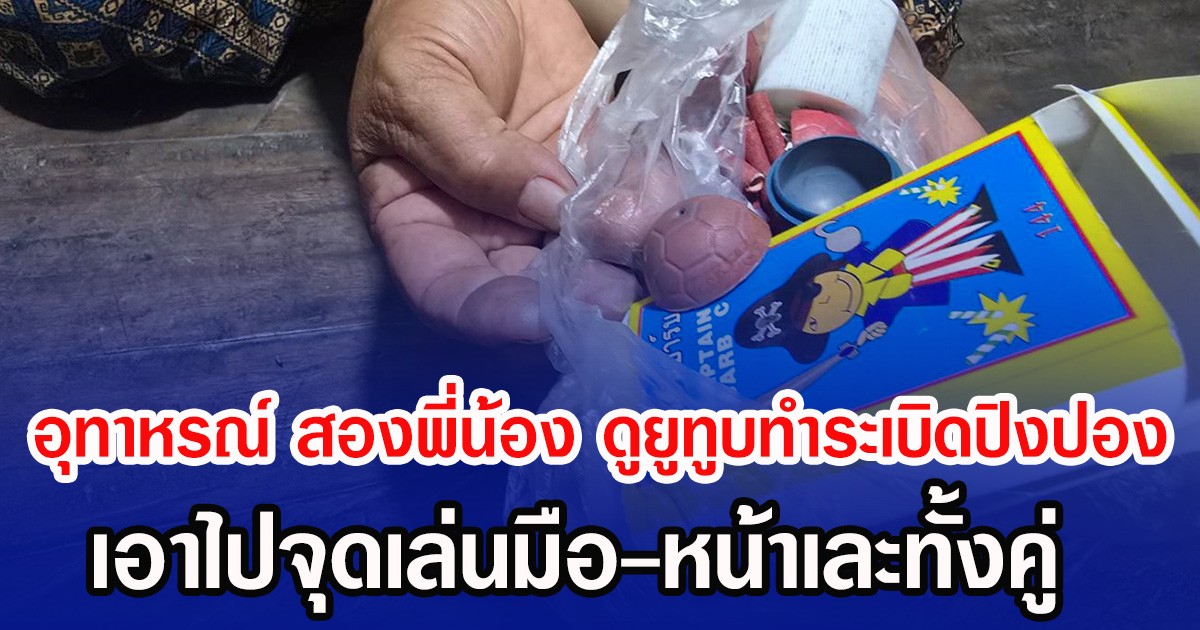 อุทาหรณ์ สองพี่น้อง ดูยูทูบทำระเบิดปิงปอง เอาไปจุดเล่นมือ-หน้าเละทั้งคู่