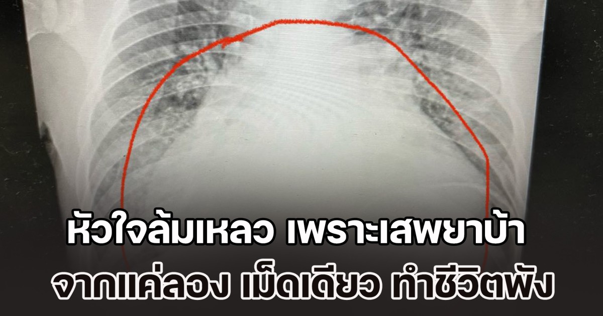 หมอเผยเคส หนุ่มวัย 22 ปี หัวใจล้มเหลว เพราะเสพยาบ้า จากแค่ลองเล่นๆ เม็ดเดียว ผ่านไป 2 ปี ทำชีวิตพัง เห็นแล้วเสียดายชีวิตแทน