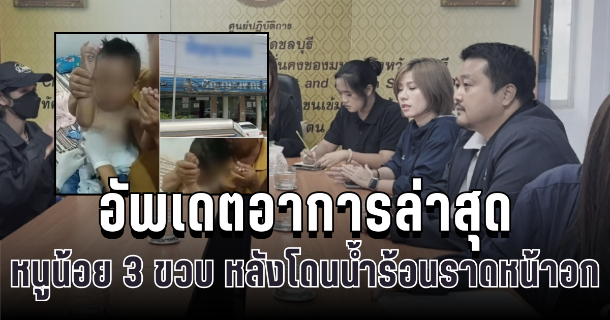 สลดใจ อัพเดตอาการล่าสุด หนูน้อย 3 ขวบ หลังโดนหมอคลินิกใช้น้ำร้อนราดหน้าอก