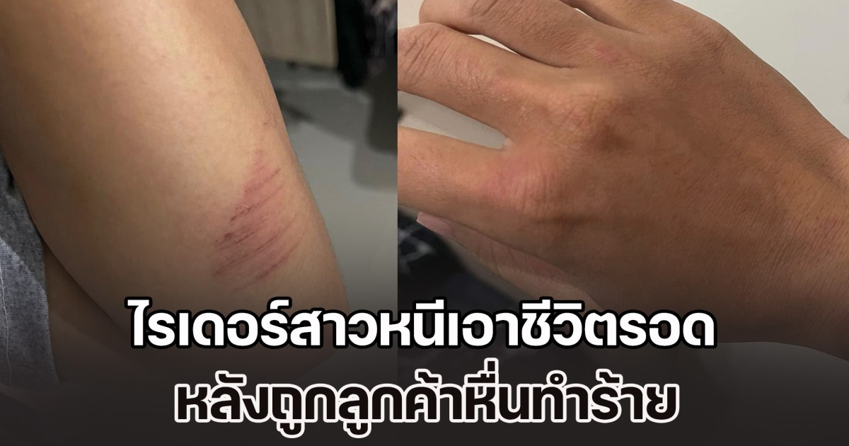 ไรเดอร์สาวหนีเอาชีวิตรอด หลังถูกลูกค้าหื่นทำร้าย ซ้ำ ตร. เมินเฉย โชคยังดีได้เพื่อนไรเดอร์ช่วยไว้ทัน