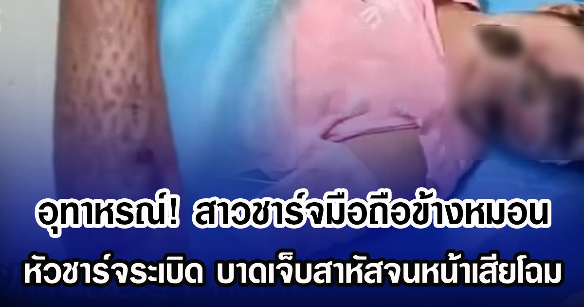 อุทาหรณ์! สาวชาร์จมือถือข้างหมอน หัวชาร์จระเบิด บาดเจ็บสาหัสจนหน้าเสียโฉม (ข่าวต่างประเทศ)