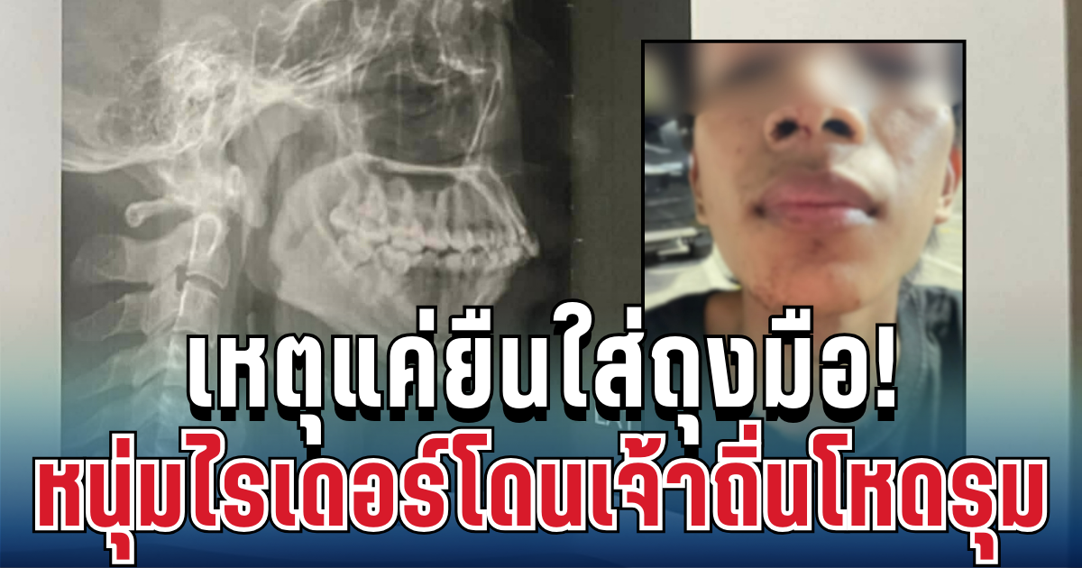 เจ้าถิ่นโหด! หนุ่มไรเดอร์โดนรุมเตะต่อย ร่างกายเจ็บสาหัส เหตุแค่ยืนใส่ถุงมือ