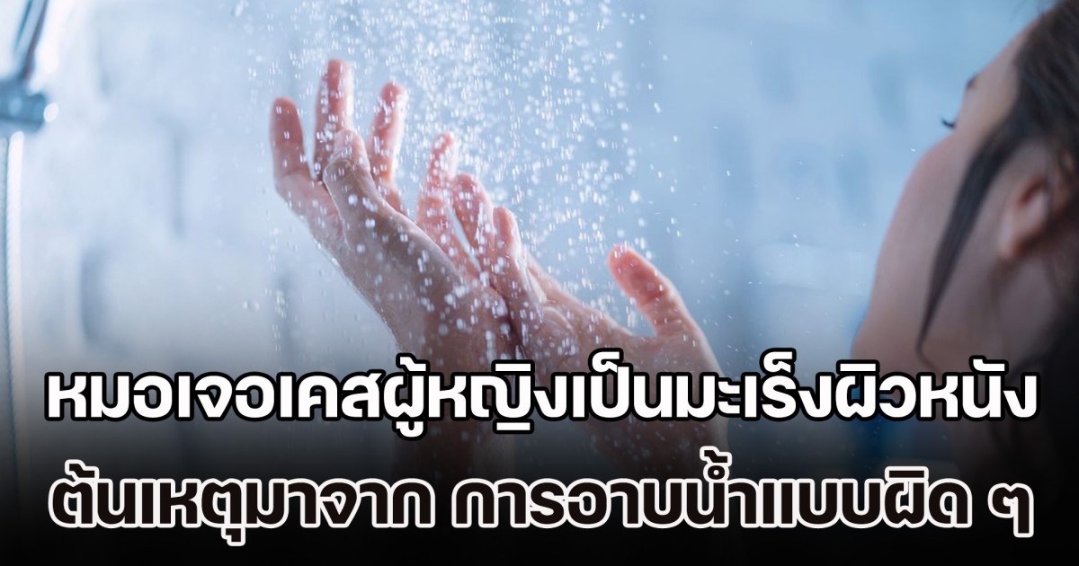 หมอมาเตือนเอง เจอเคสผู้หญิงเป็นมะเร็งผิวหนัง ต้นเหตุมาจาก การอาบน้ำแบบผิด ๆ ที่หลายคนชอบทำ