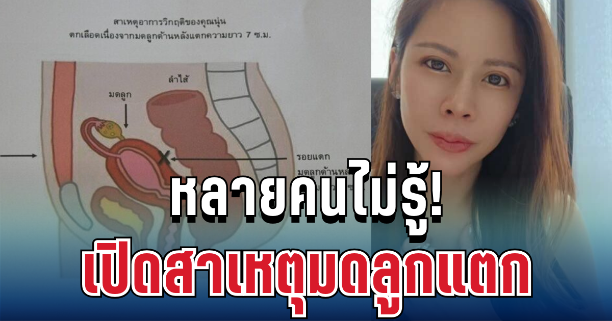 หลายคนไม่รู้! หมอของขวัญ เปิดสาเหตุมดลูกแตก ภาวะร้ายแรงที่อันตรายกว่าที่คิด