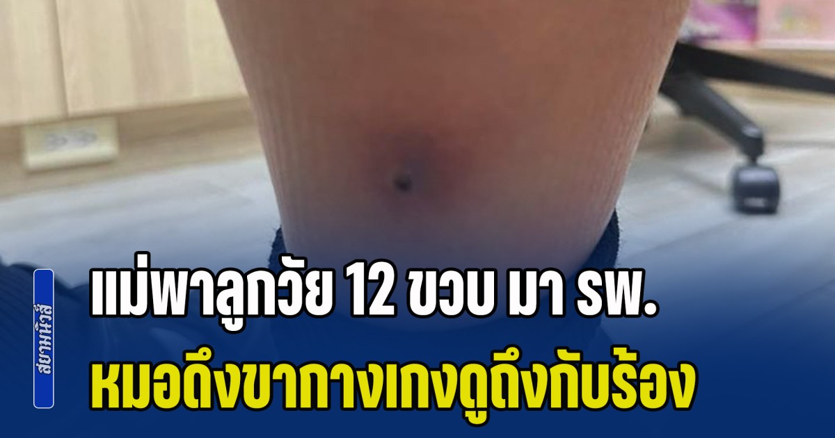 แม่พาลูกวัย 12 ขวบ มา รพ. คิดว่าแค่ไข้หวัดใหญ่ หมอผิดสังเกต ดึงขากางเกงดูถึงกับร้อง สั่งส่ง ICU ด่วน (ข่าว ตปท.)