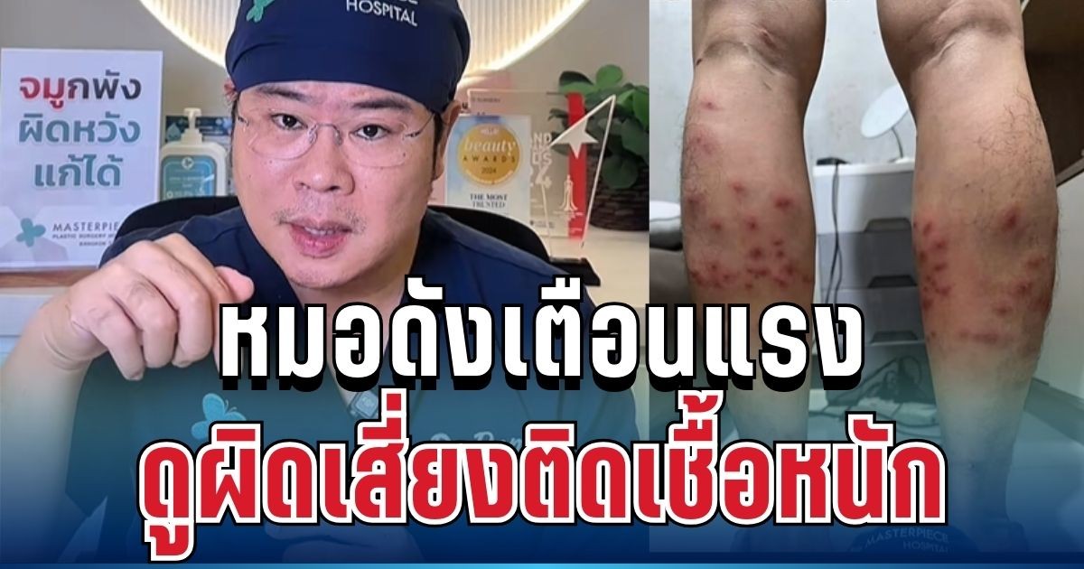 อย่าชะล่าใจ! หมอดังเตือนแรง เทียบชัดๆ ตุ่มยุง-คุ่น ดูผิดเสี่ยงติดเชื้อหนัก