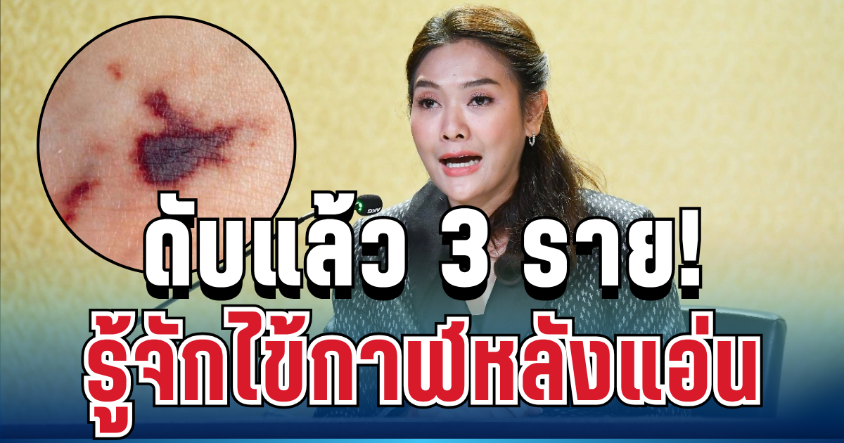 เตือนด่วน! ไทยเสียชีวิตแล้ว 3 ราย รู้จักไข้กาฬหลังแอ่น โรคร้ายแรงที่หลายคนยังไม่รู้