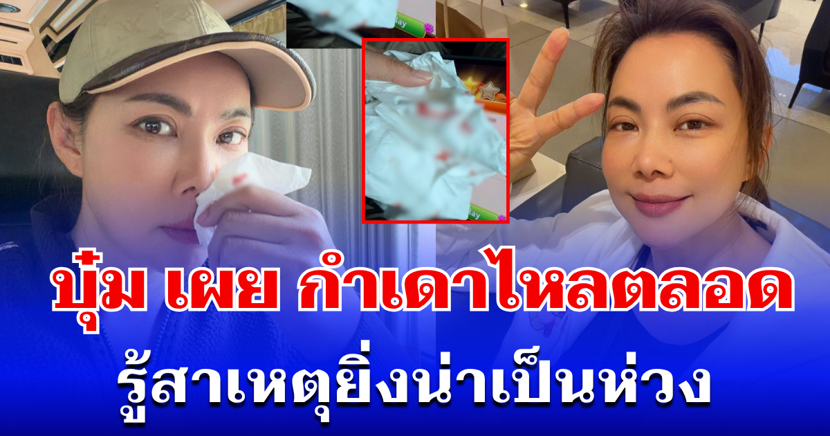 ทรมานมาก! บุ๋ม ปนัดดา เผย กำเดาไหลตลอดเวลา รู้สาเหตุยิ่งน่าเป็นห่วง